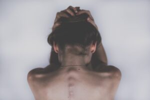敏感肌の人がVIO脱毛の痛みを軽減するための対策は？